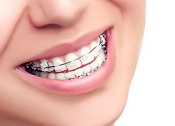 Top Dental Clinic in Lucknow