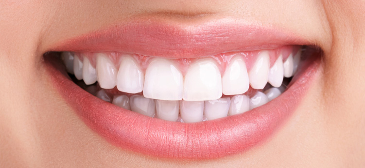 Cosmetic Dentistry in Lucknow